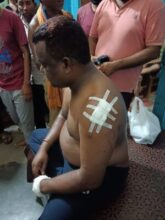 Weapon Attack: Strongly the big news of this time… Nagar Panchayat Vice President who came out on the morning walk was attacked with a sharp weapon