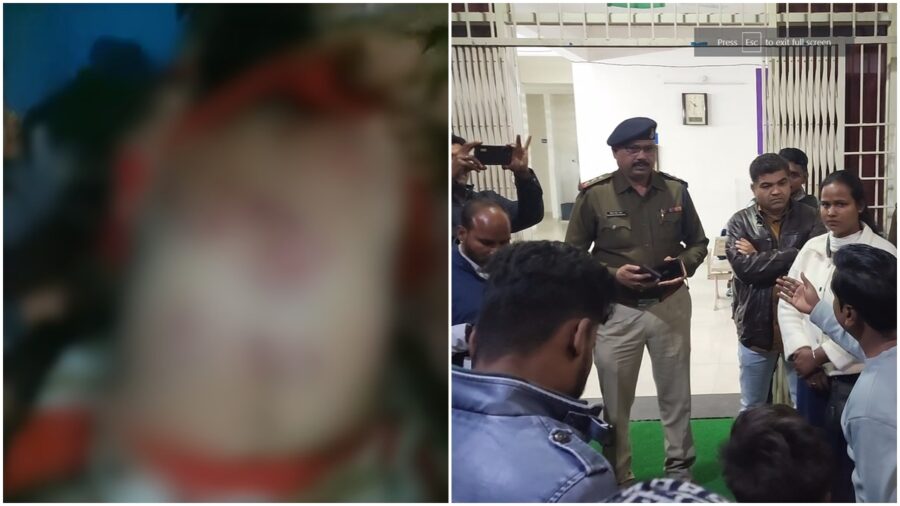 Police Brutality: Condition of beloved sister in Shivraj's 'Raj'...! Police removed Dalit woman's clothes and beat her...she suffered serious injuries
