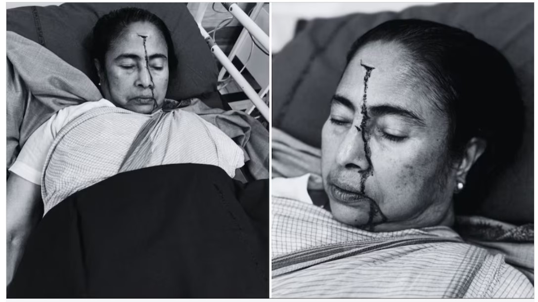 Bengal CM Mamata Banerjee suffered serious head injury...! admitted to sskm hospital