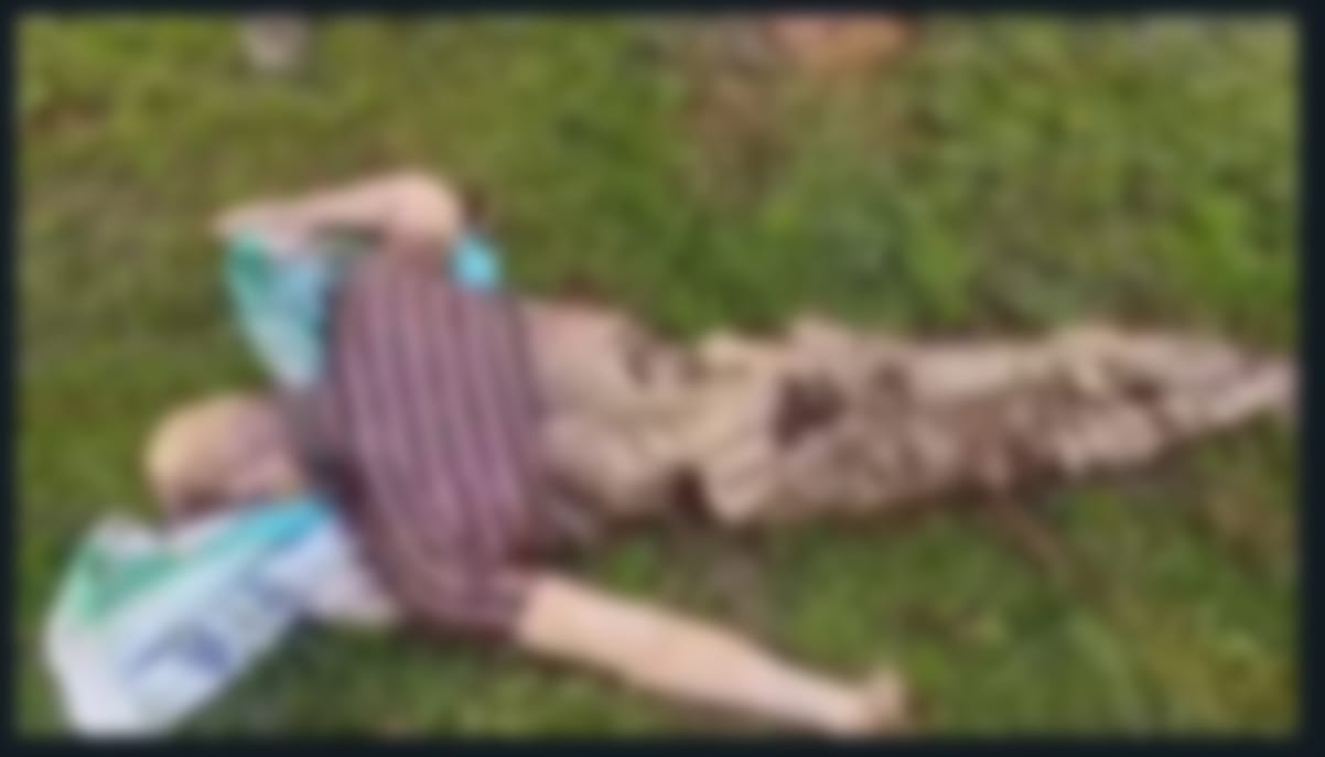 Rotten Corpse: Big news from Dhamtari district...! Rotten corpse found in bad condition... watch the scary video here