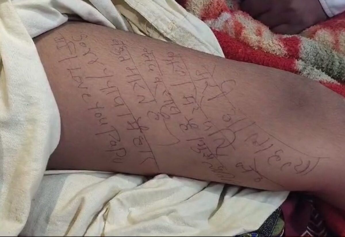 Before committing suicide, the 'daughter' wrote a suicide note on her thigh...! So that her in-laws don't find out