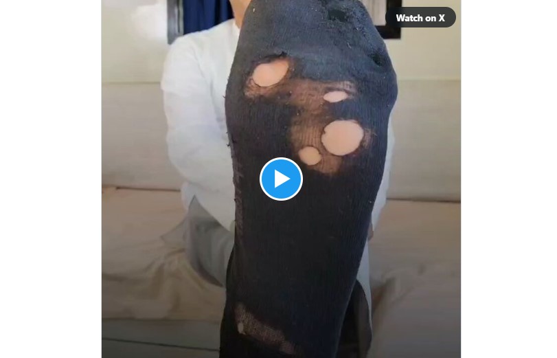 Solar Man of India: Top officer of IIT Bombay reached 5 star hotel wearing 'torn socks'...! Professor told the truth... watch the video here