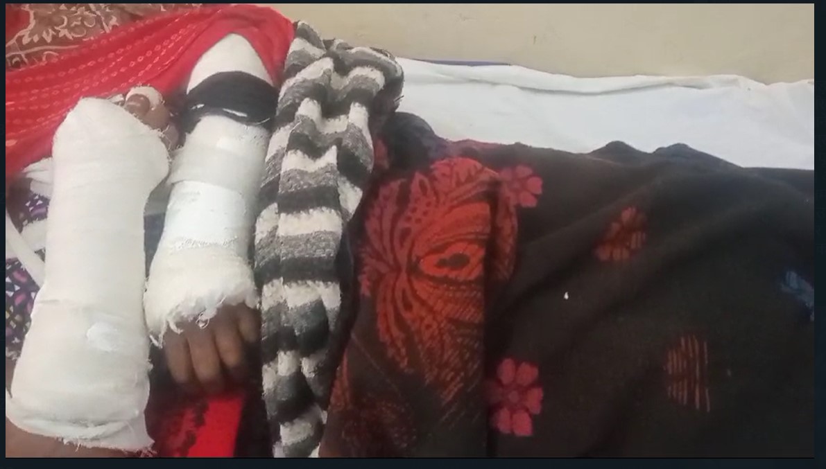 Rape Victim: Humanity shamed...! Brutality with Dalit rape victim...iron rod inserted in private part...broke hands and legs when not satisfied...watch the video here